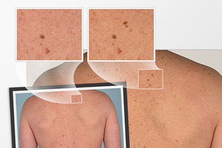 Visit Complexion Analysis in High Point & Greensboro NC