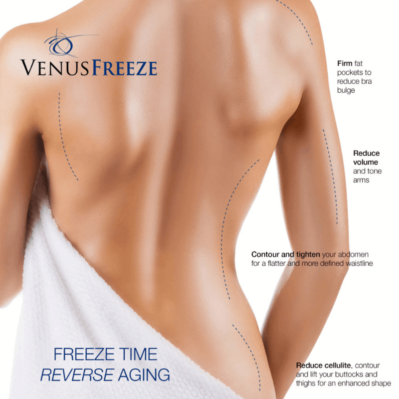 Venus Freeze in Greensboro & High Point