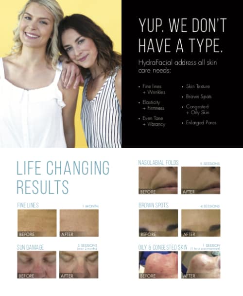 HydraFacial in Greensboro & High Point