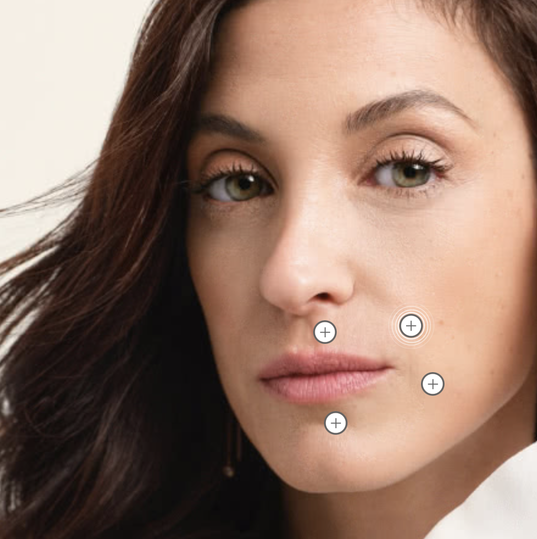 Belotero Balance + in High Point & Greensboro