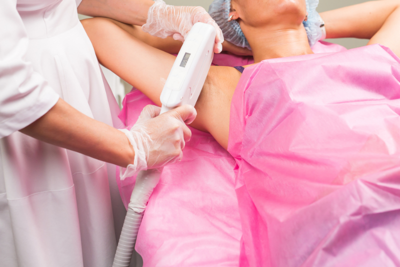IPL Hair Removal in High Point & Greensboro