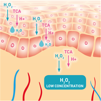 BioRevitalization Peel PRX-T33 in High Point & Greensboro